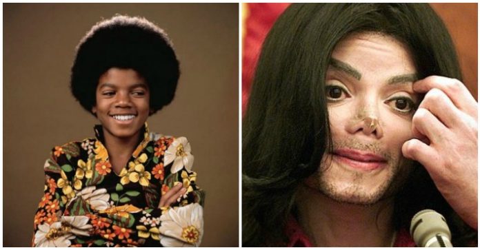 Майкл Джексон до и после операции: как менялась внешность культового певца