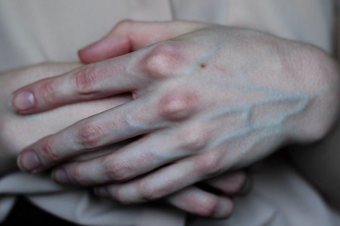 Холодные руки у ребенка — о чем говорят и нужно ли лечить?
